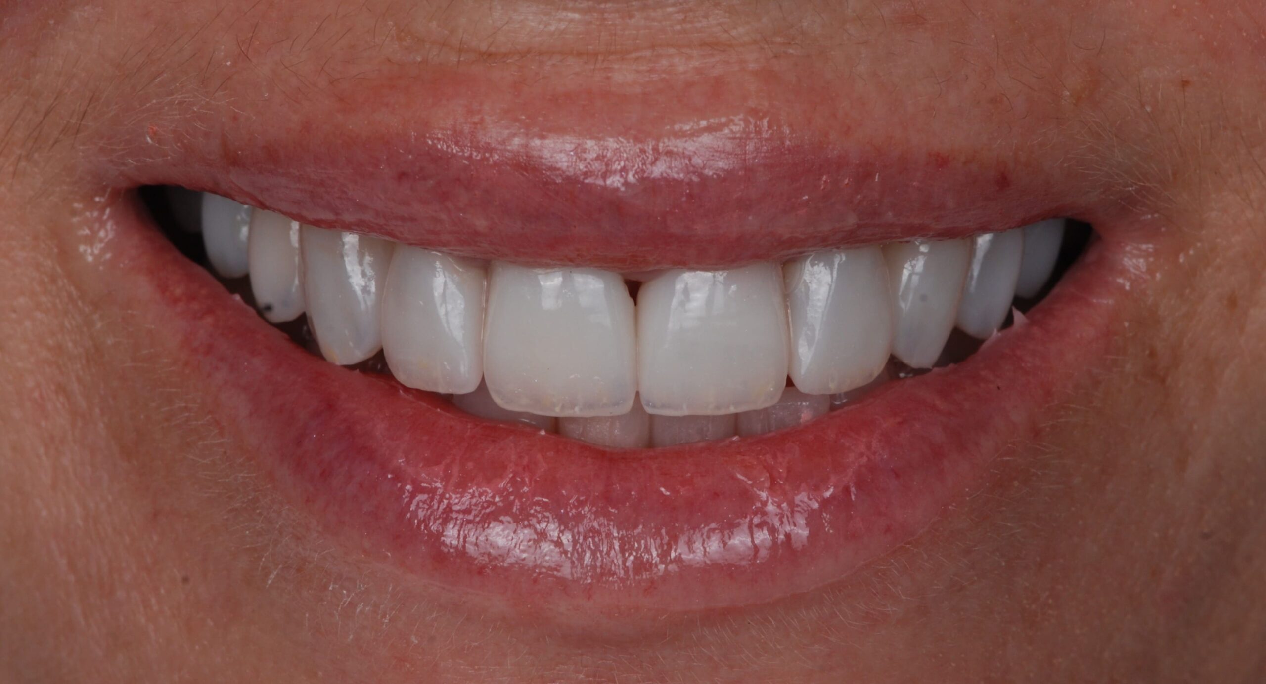 After Dr. Sandra García Martin London