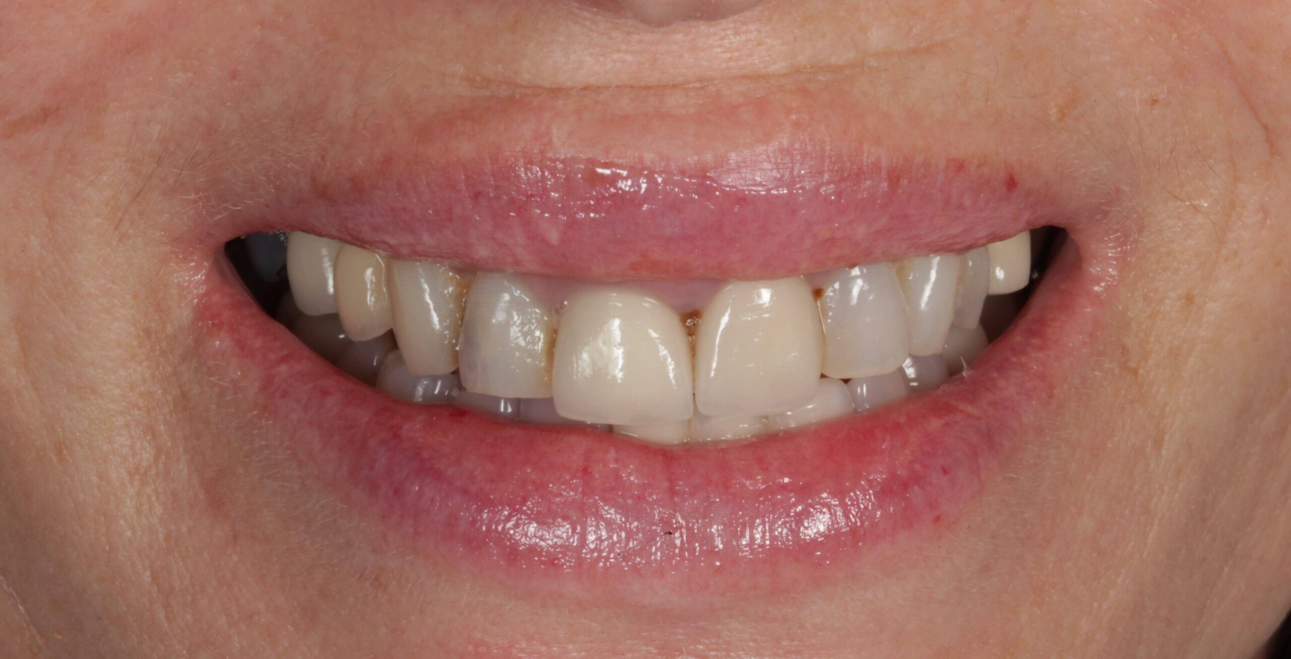 Before Dr. Sandra García Martin London