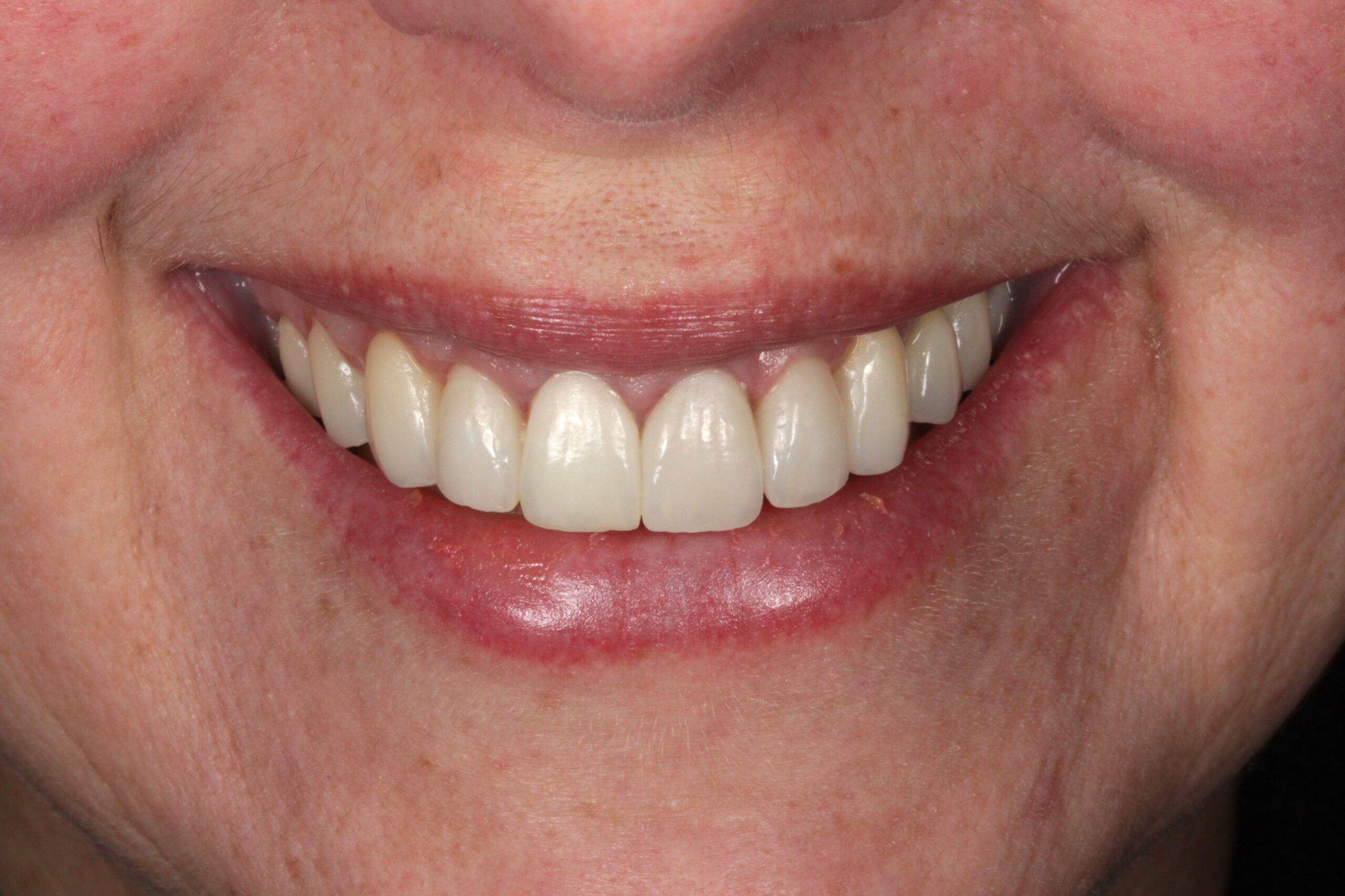 After Dr. Sandra García Martin London